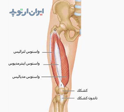 آناتومی عضله چهارسر ران یا کوادری سپس