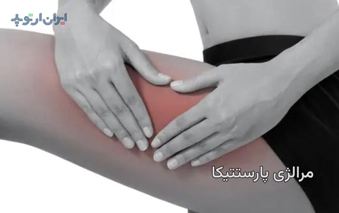 مرالژی پارستتیکا چیست و چگونه درمان میشود