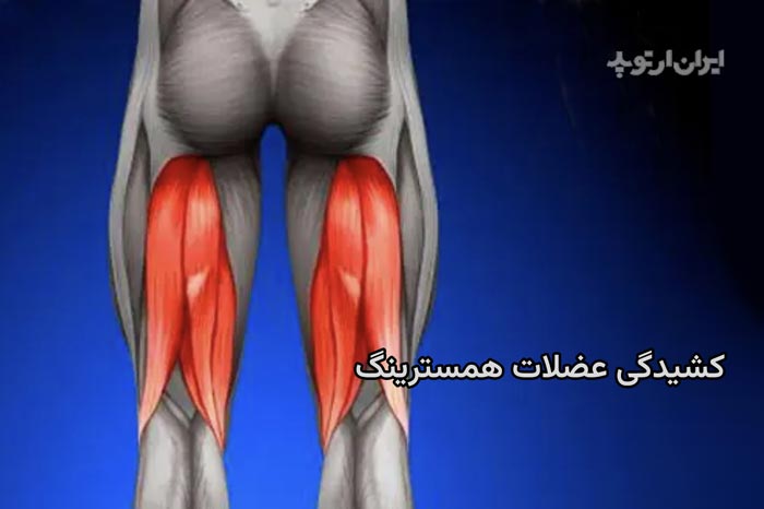 کشیدگی همسترینگ در پشت ران چگونه درمان میشود