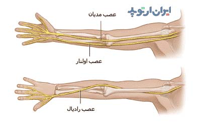 آناتومی اعصاب بازو