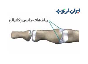 آناتومی دست. رباط جانبی انگشت دست