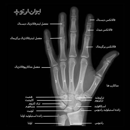 آناتومی دست. رادیوگرافی رخ کف دست