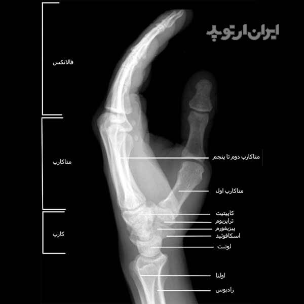 آناتومی دست. رادیوگرافی نیمرخ کف دست