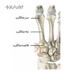 آناتومی دست. متاکارپ ها یا استخوان های کف دست