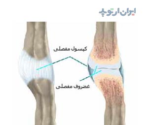 آناتومی دست. کپسول و غضروف مفصل انگشت دست