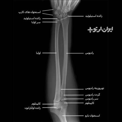 آناتومی ساعد. رادیوگرافی رخ ساعد