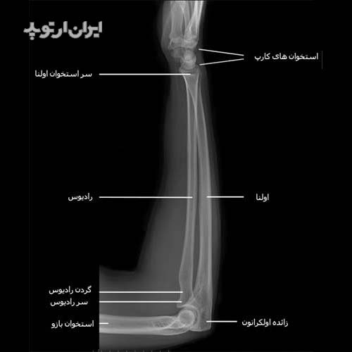 آناتومی ساعد. رادیوگرافی نیمرخ ساعد