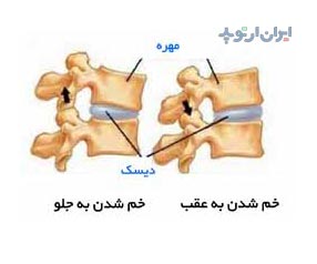 آناتومی ستون فقران حرکت مهره