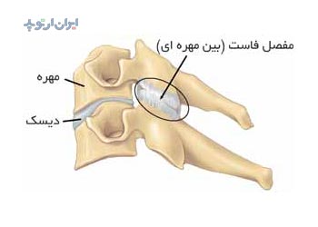 آناتومی ستون مهره فاست