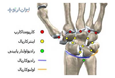 آناتومی مچ دست. مفاصل تشکیل دهنده