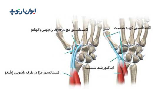 آناتومی مچ دست. رباط های مچ دست