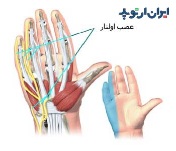 آناتومی مچ دست. عصب اولنار