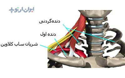 دنده گردنی