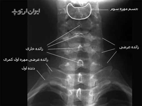 رادیوگرافی روبروی گردن