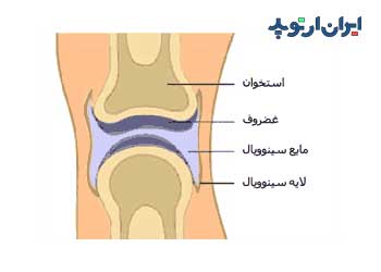 ساختار مفصل