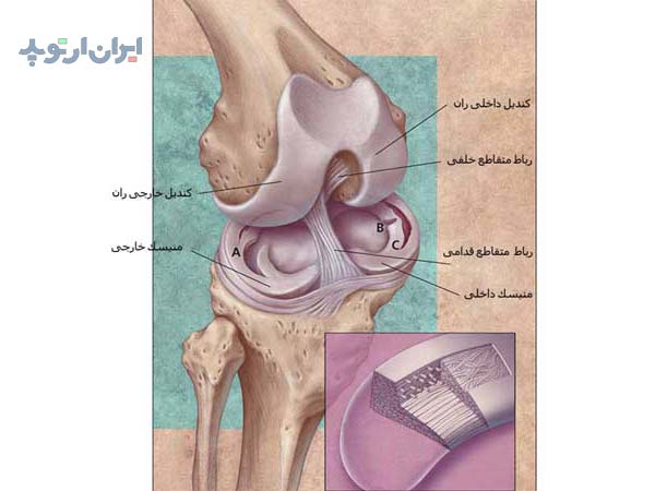 آناتومی زانو. آسیب های منیسک