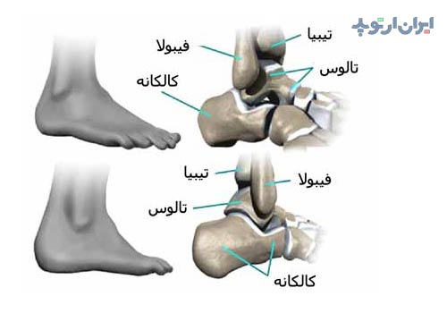 استخوان های مچ پا