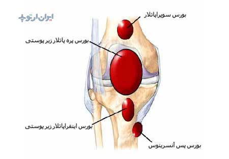 آناتومی زانو. بورس های اطراف زانو