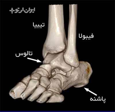 استخوان تالوس در مچ پا