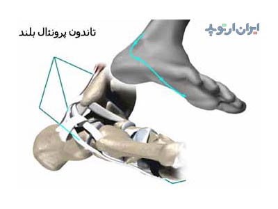 آناتومی مچ پا. تاندون های مچ پا