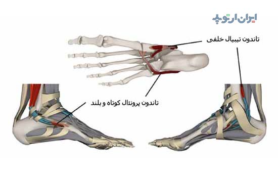 آناتومی مچ پا. تاندون های مچ پا