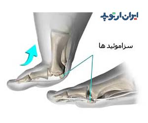 استخوان های سزاموئید در پا