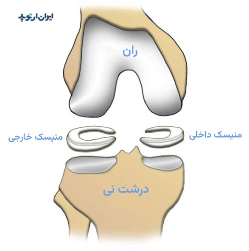 منیسک زانو دو تا هستند و  در داخل مفصل زانو قرار گرفته اند