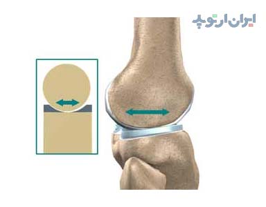 آناتومی زانو. منیسک زانو