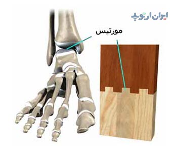 آناتومی مچ پا