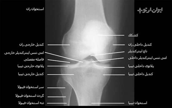 رادیوگرافی رخ مفصل زانو