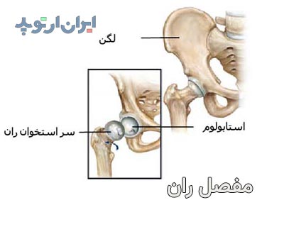 مفصل ران