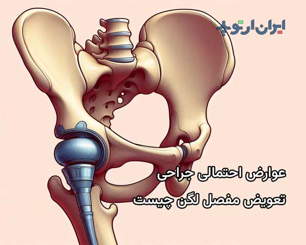 عوارض احتمالی جراحی تعویض مفصل در ناحیه لگن چیست