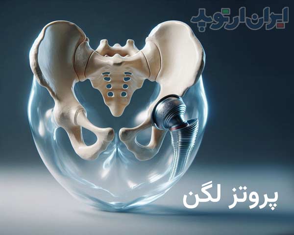 پروتز لگن چه ساختمانی و چه انواعی دارد و در کجا استفاده میشود