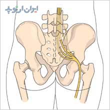  مسیر عصب سیاتیک در پشت مفصل ران است