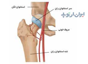 عروق مفصل ران یا هیپ