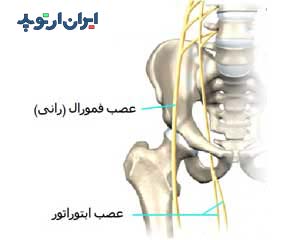 عصب ابتوراتور و رانی