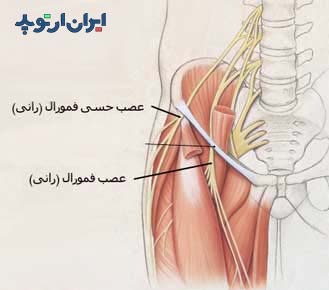 عصب فمورال یا رانی