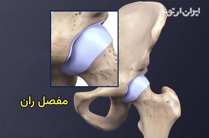 آناتومی مفصل ران