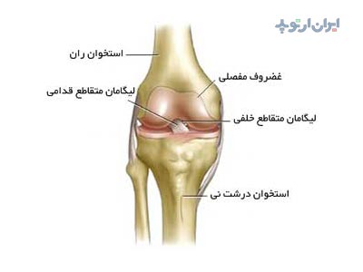 رباط صلیبی زانو