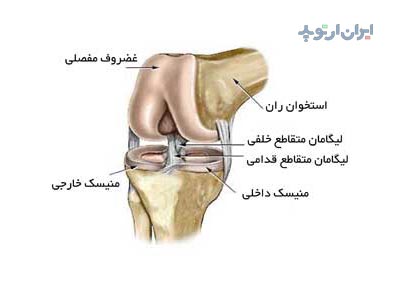 رباط acl زانو