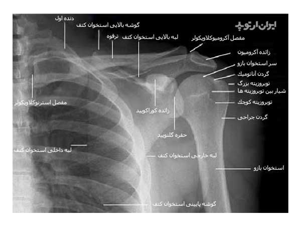 آناتومی شانه. رادیوگرافی رخ شانه