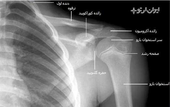 آناتومی شانه. رادیوگرافی رخ شانه قبل از بلوغ