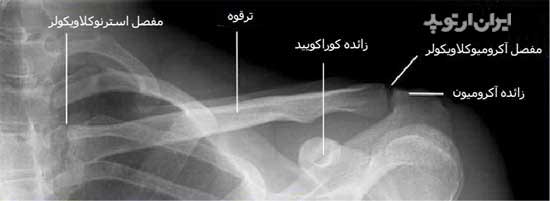 آناتومی شانه. رادیوگرافی رخ ترقوه