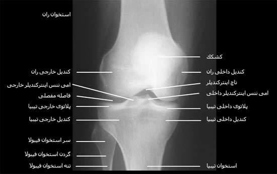   رادیوگرافی رخ مفصل زانو